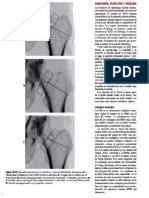 Densitometria Osea en Columna, Cadera y Antebrazo