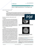 Ambil Cerebral-Abscess-Secondary-To-Mild-Scalp-In PDF