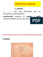 Caracterist Clínicas de Carcinoma Basocelular
