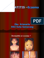 Dermatitis & Eczema 2007