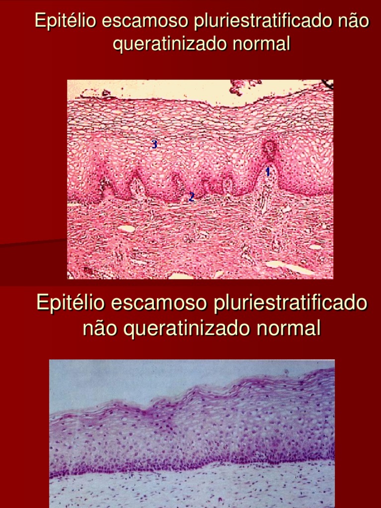 Aula 04 - Epitélio Escamoso | PDF | Epitélio | Tecido (Biologia)