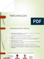 Fribromialgia 