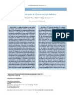 Neuropatía de Charcot