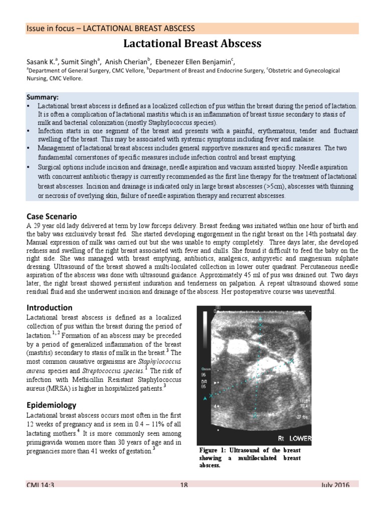 18 22 Breast Abscess PDF Breast Cancer Nipple
