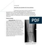 Module 5: Evaluation of The Lower Extremity (LCL Tears at The Knee) Mechanism of Injury