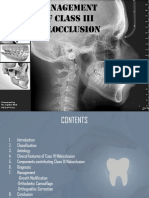 Treatment of Class III Malocclusion