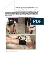 Ankle-Brachial Index: A Simple Test for PAD Diagnosis