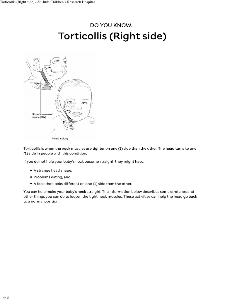 right-side-torticollis-exercises-guide-pdf