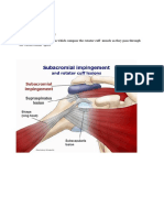Subacromial Impingement An Irritation of The Tendons Which Compose The Rotator Cuff Muscle As They Pass Through The Subacromial Space