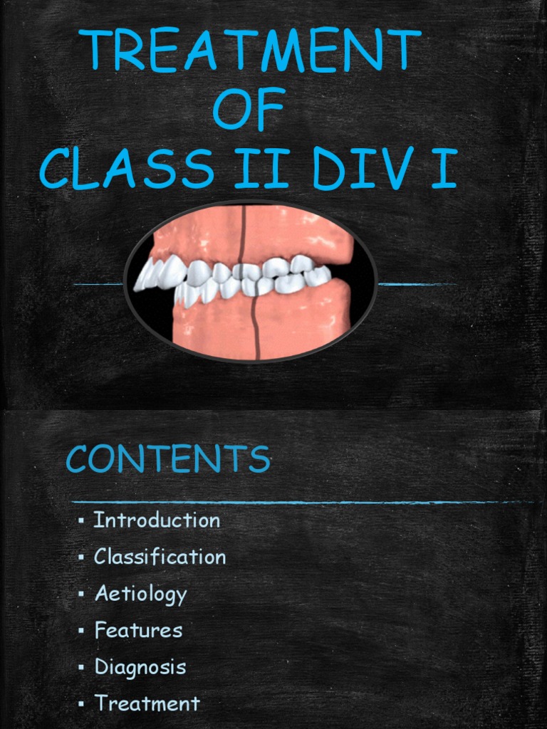 Class 2 Div 1 My Download Free PDF Orthodontics Dentistry Branches