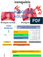 BRONQUITIS AGUDA Unido