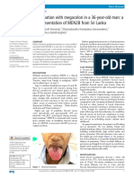 Constipation With Megacolon in A 36-Year-Old Man: A Rare Presentation of MEN2B From Sri Lanka