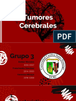 Tumores Cerebrales