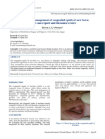 Diagnosis and Management of Congenital Epulis of New-Born: A Rare Case Report and Literature Review