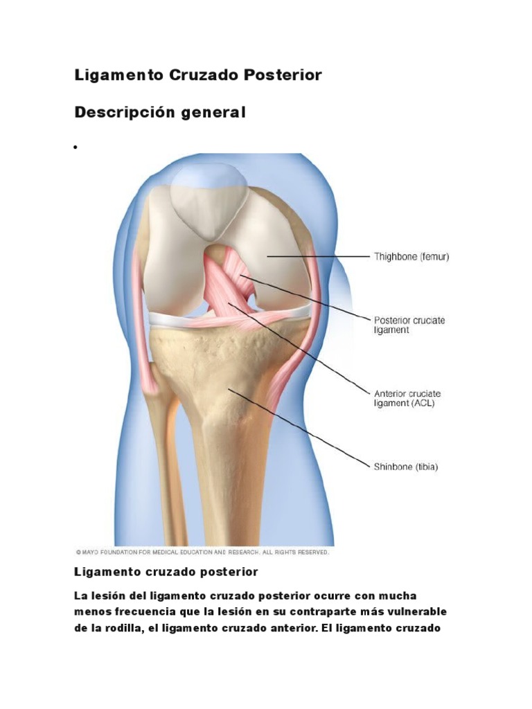 Lesión del ligamento cruzado anterior (LCA) - Dr. Edgar Sempertegui Soria, image size:768x1024