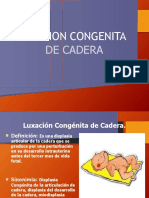 Luxacion Congenita de Cadera