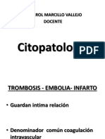 Trombosis