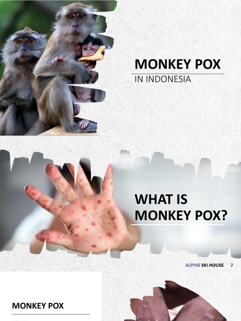 Understanding Monkeypox in Indonesia | PDF