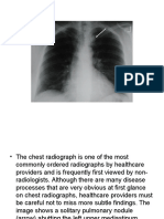 Easy To Miss On Chest Radiographs