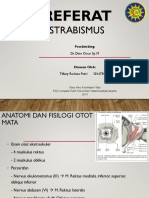 Strabismus