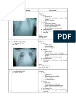 116215684-Radiologi-Expertise-Thorax.docx
