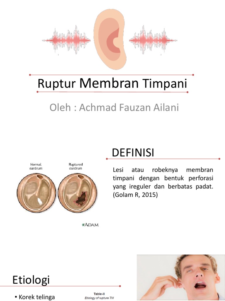 Ruptur Membran Timpani PDF