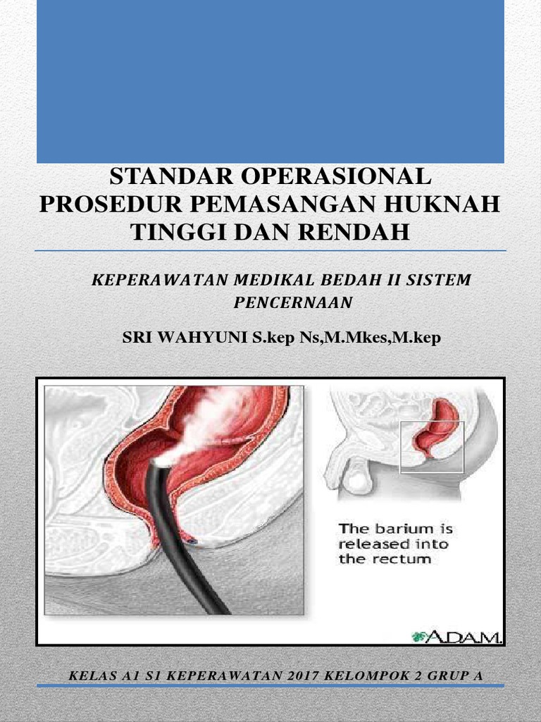 Prosedur Pemasangan Huknah Tinggi-Rendah | PDF