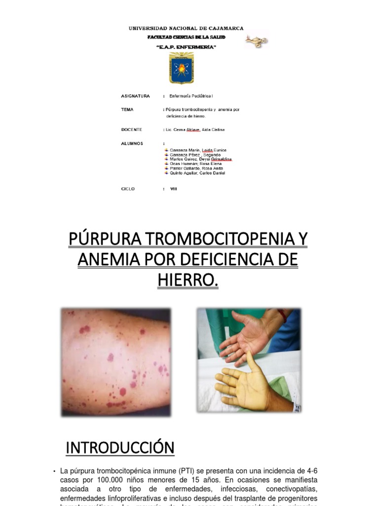 Anemia Por Deficit de Hierro Correcto CD | PDF | Anemia | Sangre