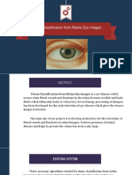 Tissue Classification From Retina Eye Images