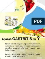 Gastritis