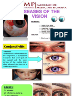 Diseases of the Vision