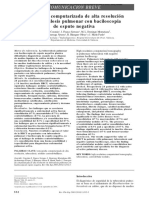 To Mo Grafía Co Mputarizada de Alta Re So Lució N e N Tube Rculo Sis Pulmo Nar Co N Bacilo Sco Pia de e Sputo Ne Gativa