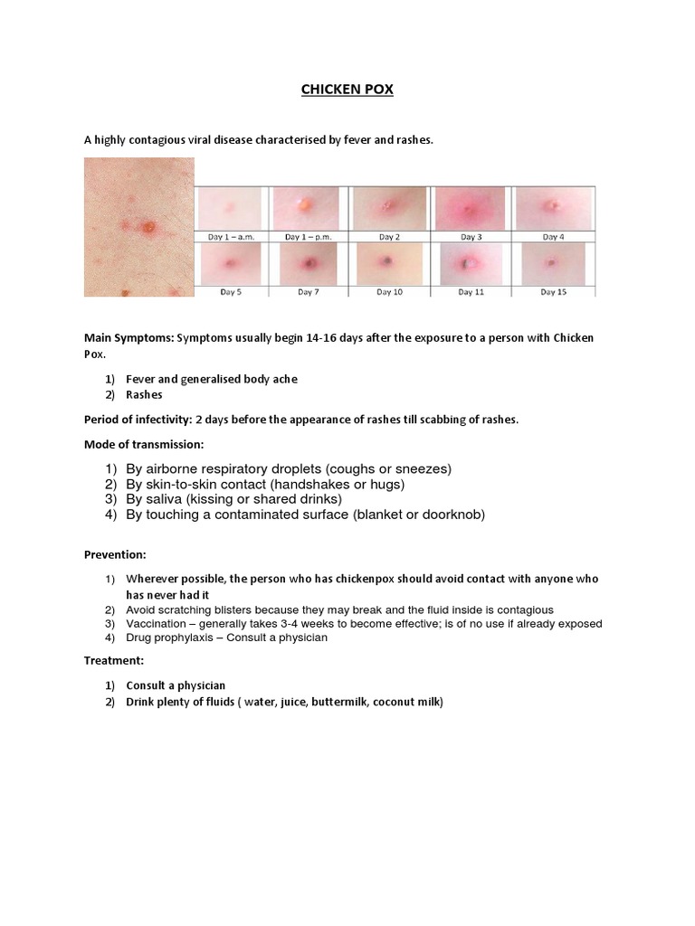 Chicken Pox: Main Symptoms: Symptoms Usually Begin 14-16 Days After The