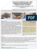 Celulitis tuberculosa como manifestación inusual de tuberculosis cutánea