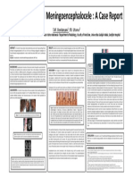 Fronto-Ethmoidal Meningoencephalocele: A Case Report: TAF. Benitaryani, PD. Utomo
