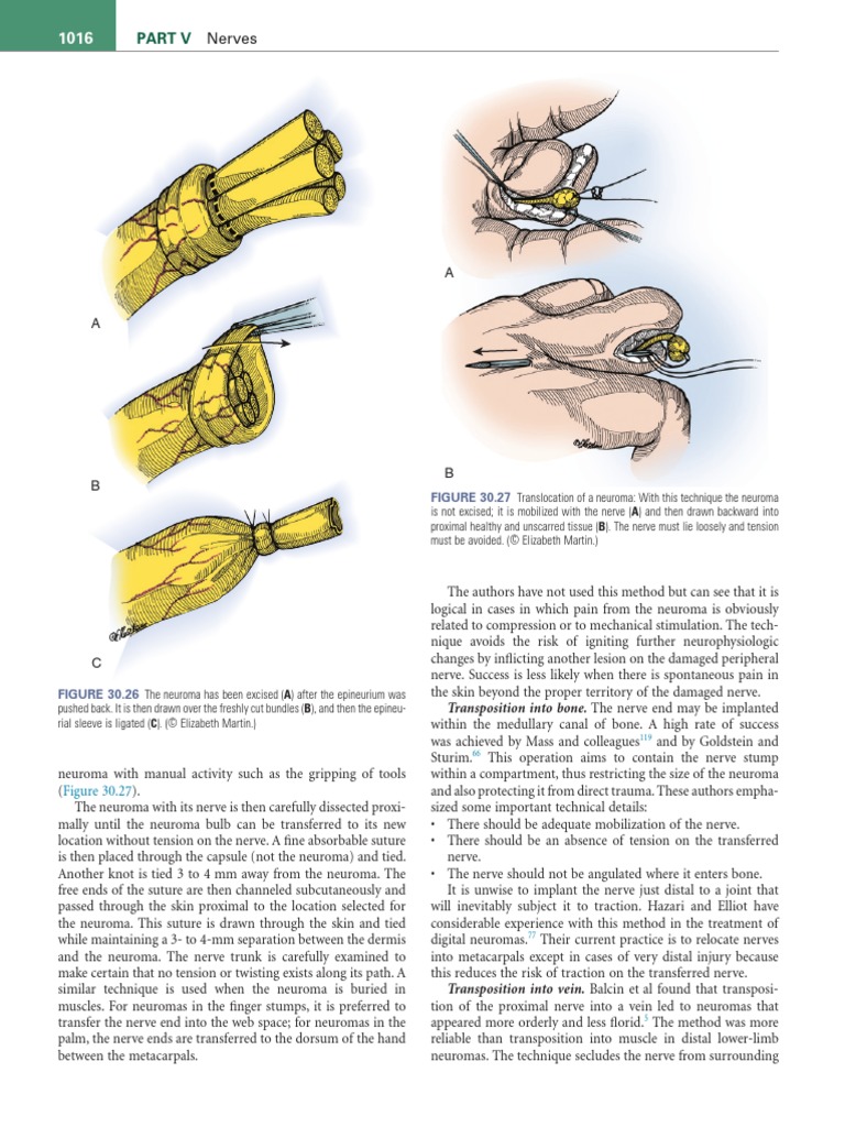 健康・医学 Green's operative hand 7th edition Green's Operative Hand Surgery 7th Edition, With Code