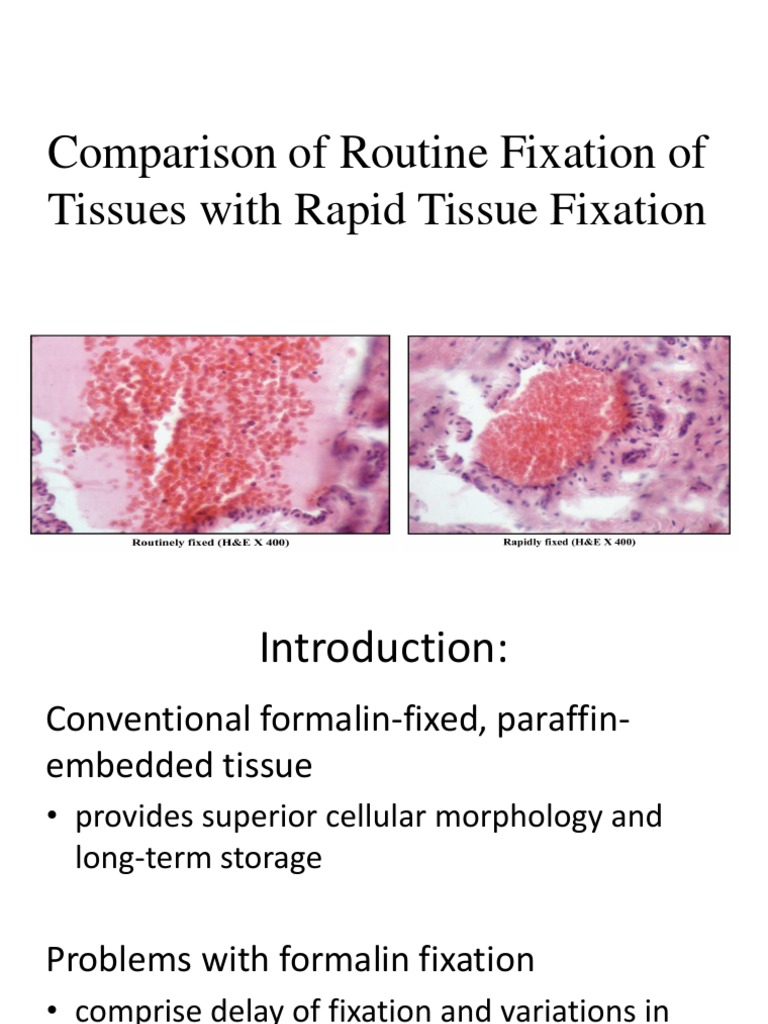 Comparison of Routine Fixation of Tissues With Rapid PDF Fixation