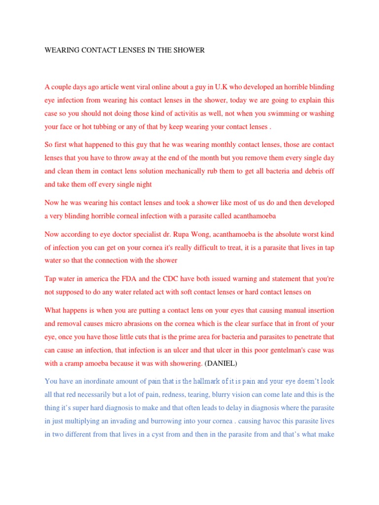 Wearing Contact Lenses in The Shower PDF Contact Lens Cornea