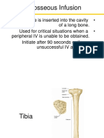 Intraoseus Infusion