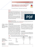 Hyperdense Appearance in Active Epidural and SDH Serial Case Report