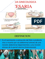 Cirugía Ginecologicacesaria