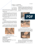 Acrodermatitis Enteropathica - A Case Report: Rashmi Mittal, Sudha R, Murugan S, Adikrishnan, Shobana S, Anandan S