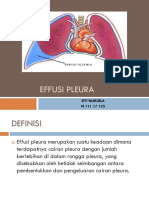 Efusi Pleura