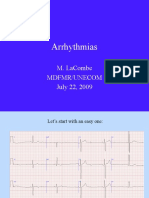 Arrhythmias: M. Lacombe Mdfmr/Unecom July 22, 2009