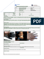 Informe de Investigación Accidente Jyd 01