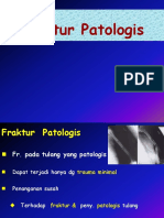 Fractur Patologis 