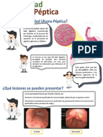 Infografía Ulcera Péptica