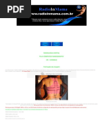 Radiologia Digital-Sistema Fuji CR