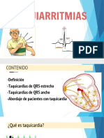 Taquiarritmias: definición, clasificación y abordaje