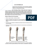 Informe Clavo Intramedular